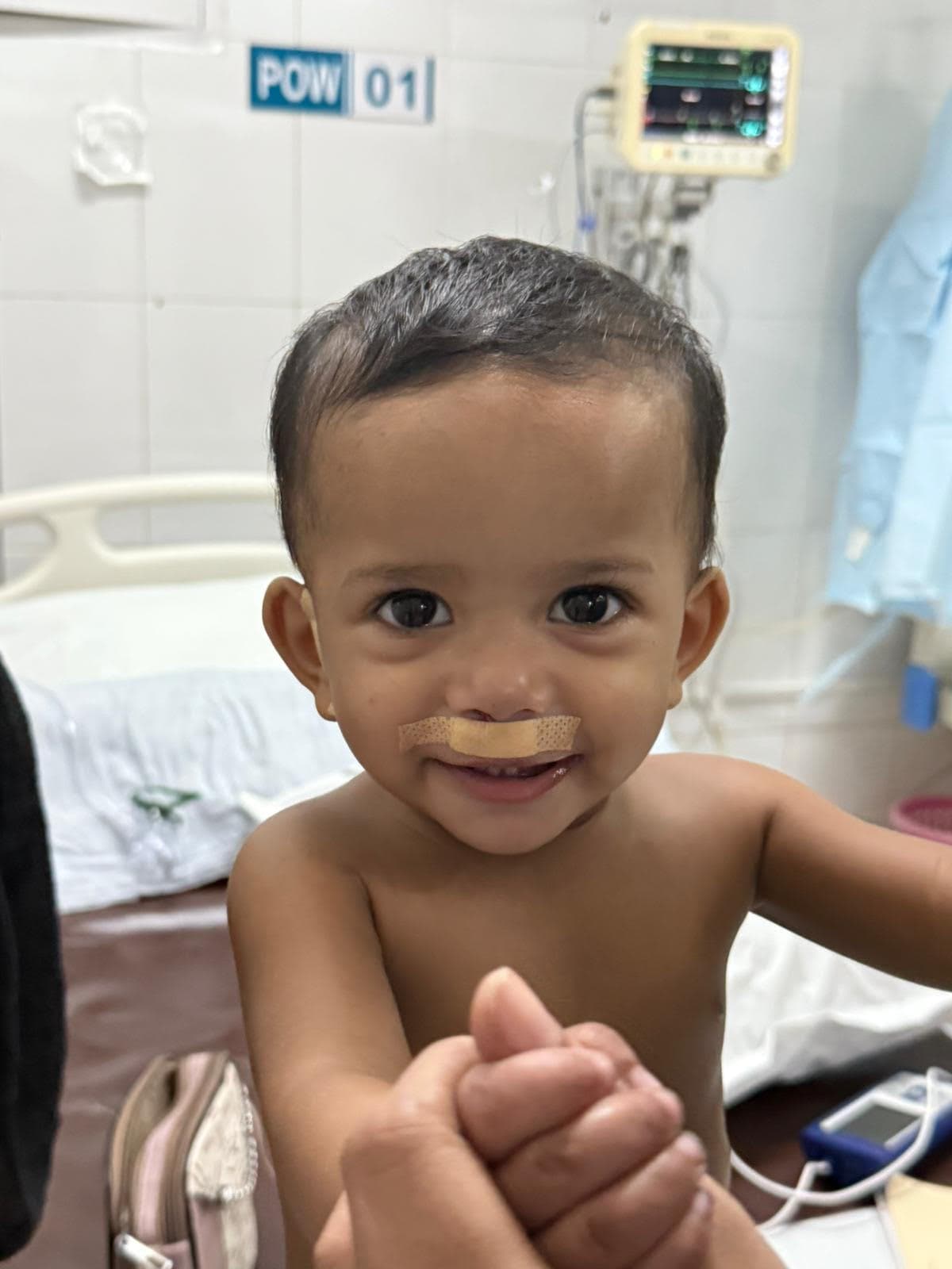 Child smiling after successful cleft surgery